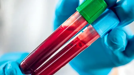 Testul de sânge care poate ”revoluționa” detectarea bolii Alzheimer