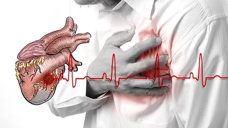 De ce sunt mai multe cazuri de infarct de sărbătorile Crăciunului