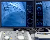 Cât durează o angiografie la Memorial România și când primești rezultatele?