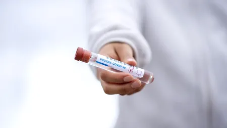 Testele pentru coronavirus, din salivă, ar fi mai sensibile decât cele nazofaringiene