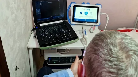 800 de specialiști, pregătiți printr-un program cu finanţare europeană pentru screeningul avansat al bolilor hepatice cronice