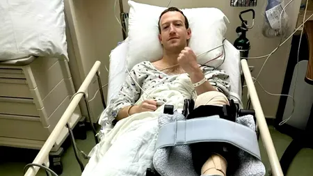 Mark Zuckerberg, imagine cruntă din spital: „Sunt recunoscător medicilor și echipei care mă îngrijește”