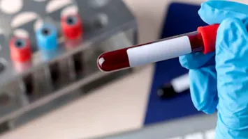 Japonia a marcat un punct de cotitură în istoria medicinii moderne. Au început primele teste clinice cu sânge artificial pe oameni