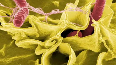 Epidemie de salmoneloză în Europa, transmite Centrul european pentru prevenirea și controlul bolilor