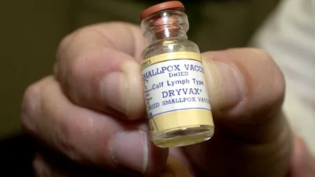 Al doilea caz de variola maimuței: Un bărbat în vârstă de 32 de ani