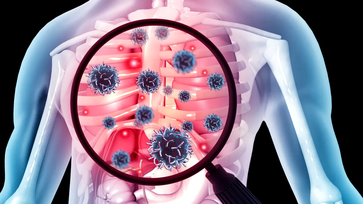 Tuberculoza ar putea redeveni o amenințare globală?