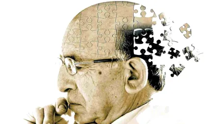 Un nou medicament contra Alzheimer, care ar putea stopa evoluția bolii!