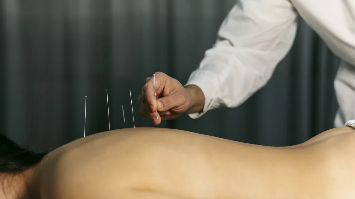 Acupunctura, mai periculoasă decât pare. Cum pot firele de aur distruge articulațiile