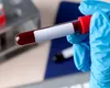 Japonia a marcat un punct de cotitură în istoria medicinii moderne. Au început primele teste clinice cu sânge artificial pe oameni