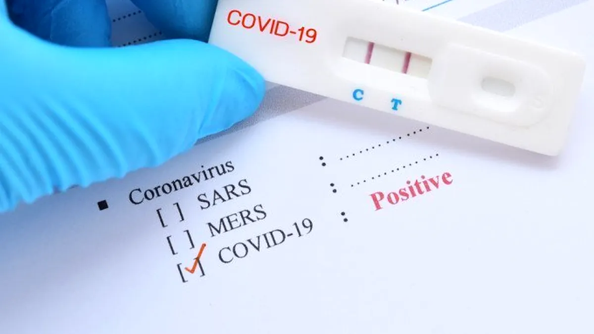Studiu coronavirus: Ce efecte se resimt chiar și după şase săptămâni