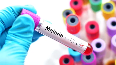 Malaria rezistentă la medicamente, o nouă amenințare!