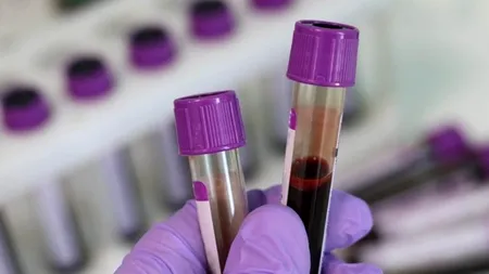 Hemoleucograma, un test simplu, salvator de multe boli grave