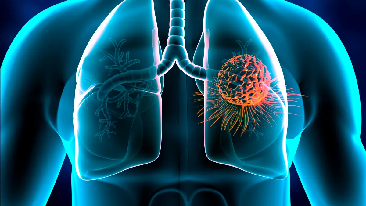 Simptome de pe față care pot indica un cancer pulmonar!
