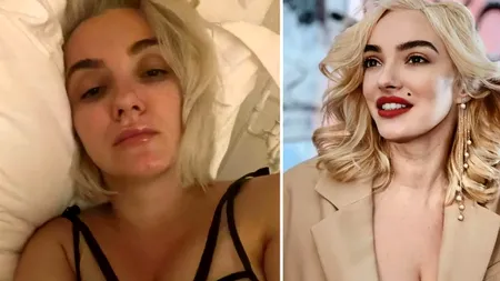 Ce „boală” are Ana Morodan. E destul de grav