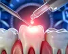 Premieră mondială: Medicamentul care regenerează dinții, testat în Japonia