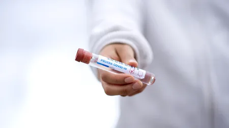 Dolj: Craiovenii pot face gratuit teste RT-PCR la Spitalul 