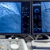 Cât durează o angiografie la Memorial România și când primești rezultatele?