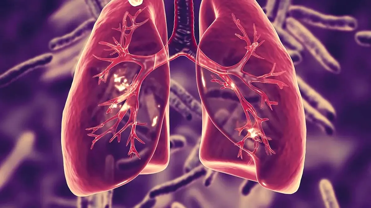 Tuberculoza a revenit pe prima poziţie în clasamentul bolilor infecţioase mortale